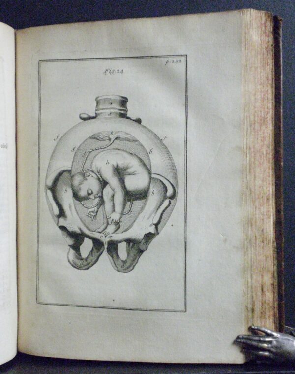 HENRY DE DEVENTER Observations importantes sur le manuel des accouchemens (1739)