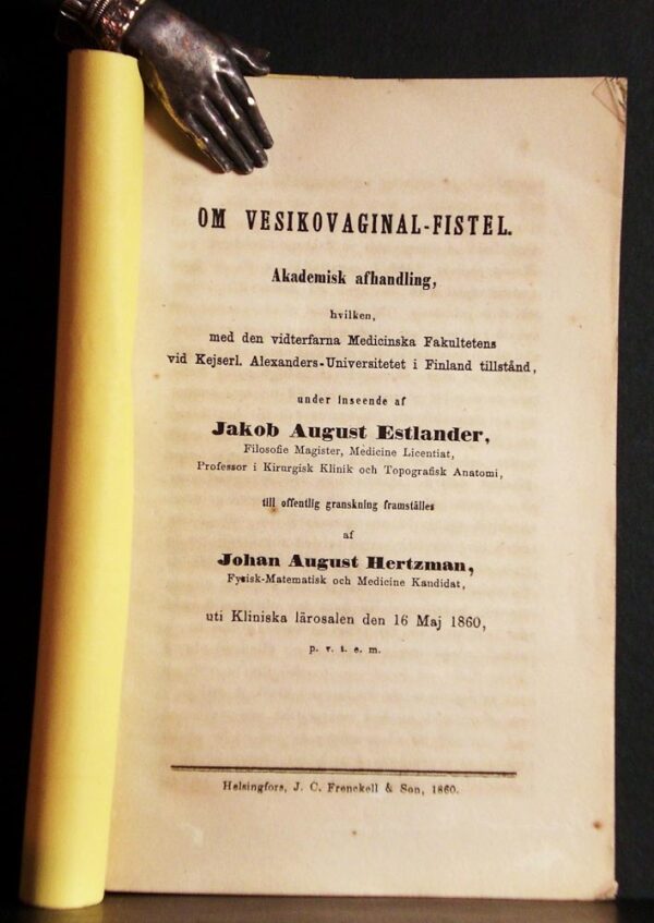 JOHAN AUGUST HERTZMAN Om vesikovaginal-fistel (1860)
